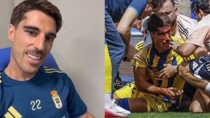 Nacho Vidal reaparece y muestra sus heridas de guerra