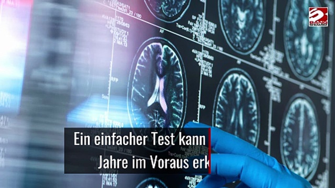 Ein einfacher Test kann Alzheimer Jahre im Voraus erkennen