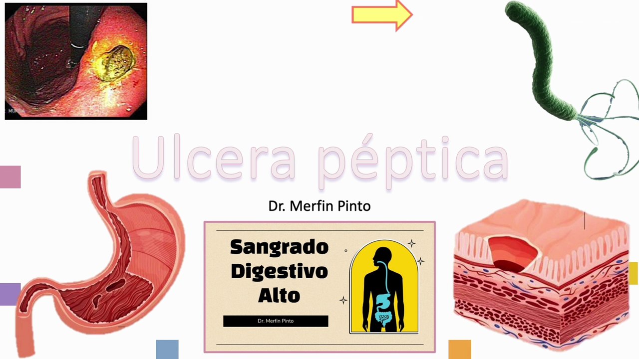 Ulcera péptica #elcuerpoymas #salud #medicina #ulcerapeptica