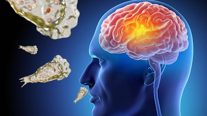 'दिमाग खाने वाला' अमीबा बन रहा जानलेवा, ऐसे लेता है ब्रेन में एंट्री