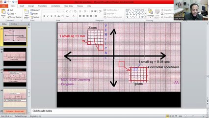 Rhythm lead, Calibration, Calculation of various intervals, heights, depth of Various Waves & Axis