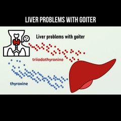 Liver problems with goiter