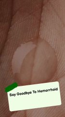 Hemorrhoid No More – Fast, Natural & Long-Term Relief