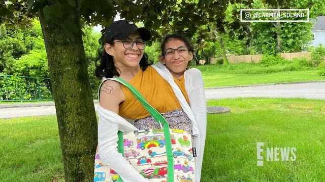 How Conjoined Twin Lupita Andrade Busies Self When Sister Is Intimate _ E! News