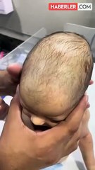 Yeni doğan bebeğin bıngıldağına basan doktorun gördüğü manzara şok etti