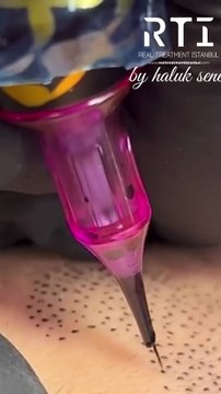 Saç Simülasyonu By Haluk Şener Saç Çözümleri Pigment İşleme SMP Telefon Aşağıda