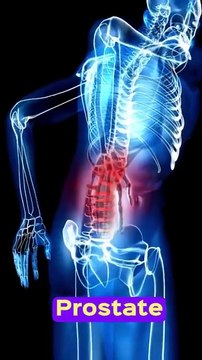Benign Prostatic Hyperplasia (BPH)