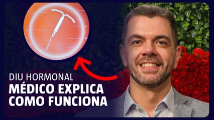 DIU hormonal: médico ginecologista mostra como funciona