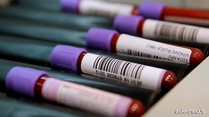 Hiv/Aids, svolta storica: prevenzione a 34 euro l'anno dal 2027