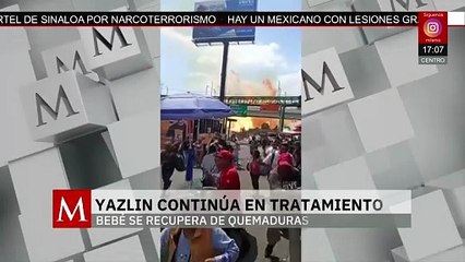 Tragedia en Iztapalapa: bebé Yazlin se encuentra estable y sigue recuperándose