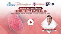 Biopsias cardíacas