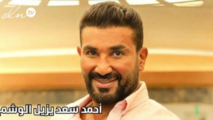 أحمد سعد يزيل الوشم من ذراعه