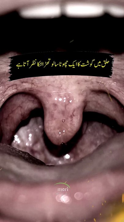 How important this tiny part in our Mouth