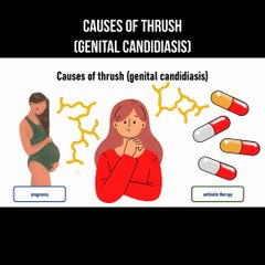 Causes of thrush (genital candidiasis)