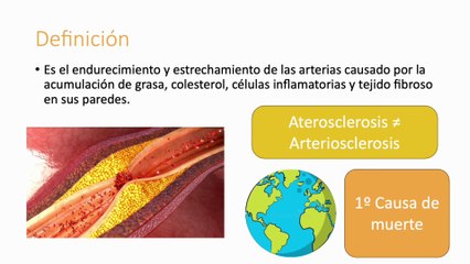 Aterosclerosis #elcuerpoymas #salud #medicina #aterosclerosis