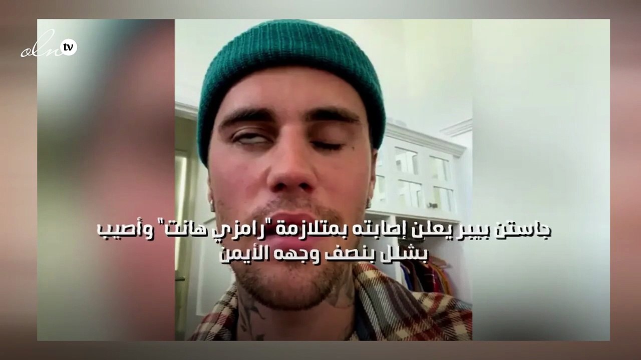 جاستن بيبر يعلن إصابته بمتلازمة "رامزي هانت" وإصابته بالشلل النصفي