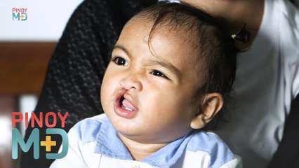 Sanhi ng kondisyon na cleft lip at palate, alamin! | Pinoy MD