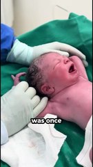 Luckiest baby in world 😱 #facts #shorts #viral #trending #baby