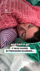 She suffered a serious rupture during labor... 😱