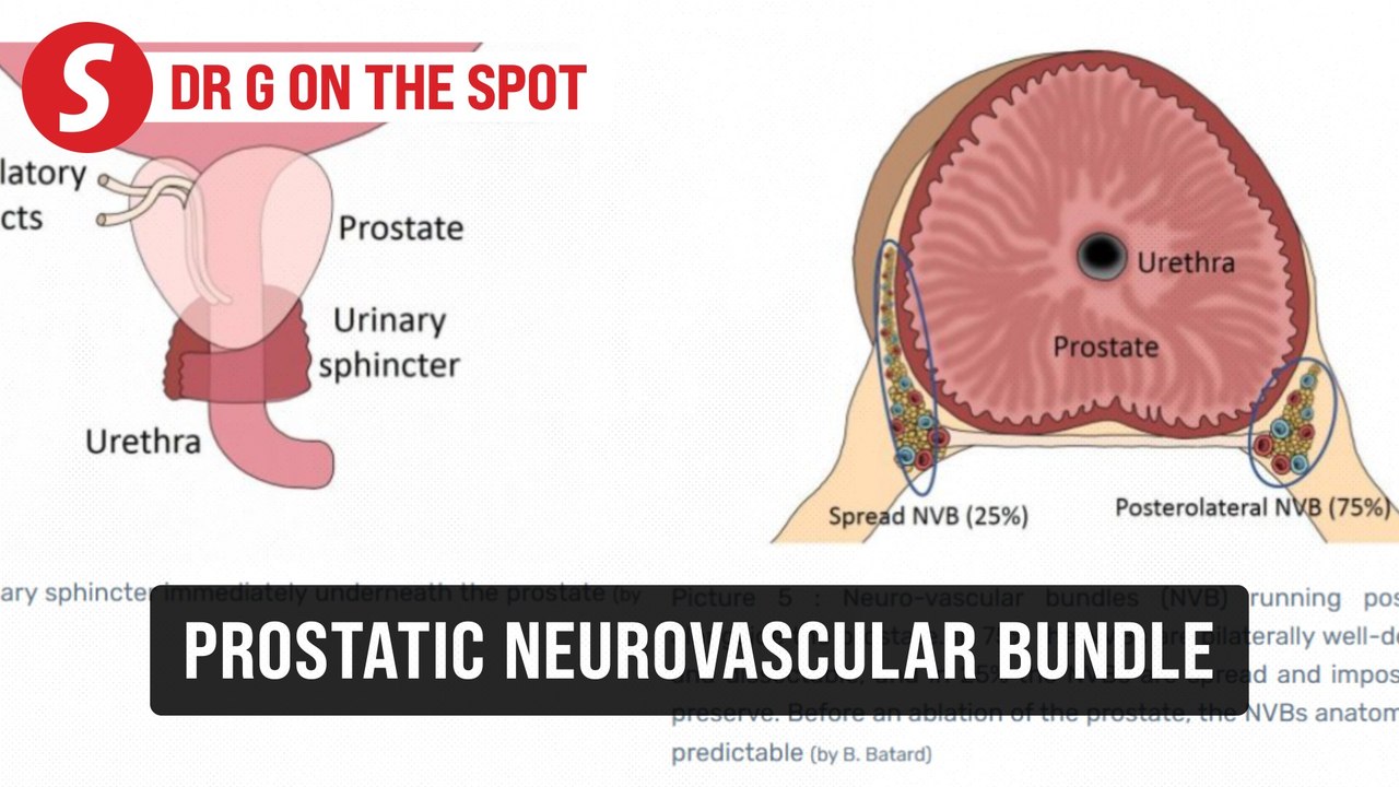 EP293: The factor of prostatic neurovascular bundle | PUTTING DR G ON THE SPOT
