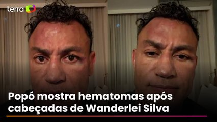 Popó mostra hematomas após cabeçadas de Wanderlei Silva