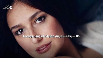 حلا شيحة تَسخر من عمليات التجميل بوجهها