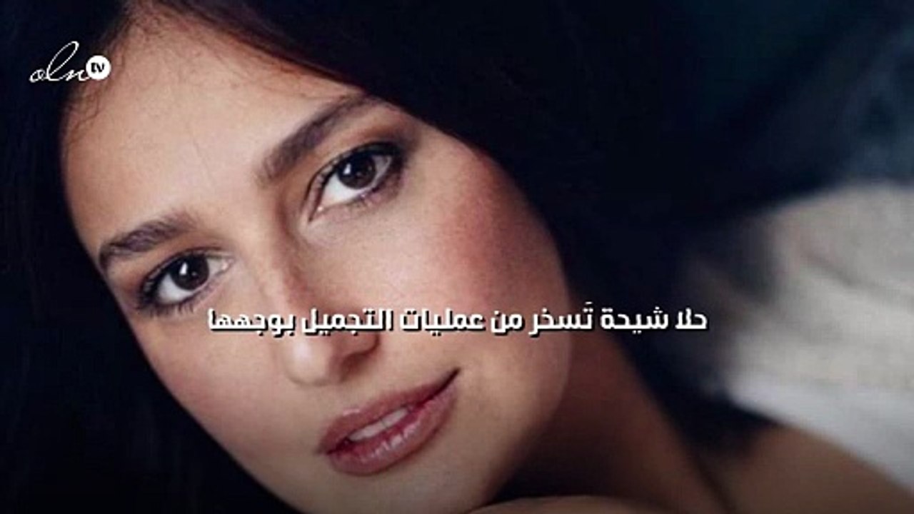 حلا شيحة تَسخر من عمليات التجميل بوجهها