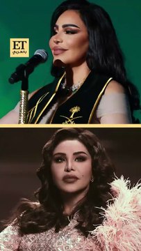 أحلام تكشف عن نتائج عملية تجميل أنفها بعد 3 أشهر