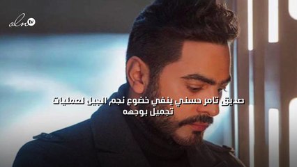 صديق تامر حسني ينفي خضوع نجم الجيل لعمليات تجميل بوجهه