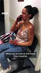 طبيب تجميل يصلح وجوه الناس المتضرّرة من انفجار بيروت