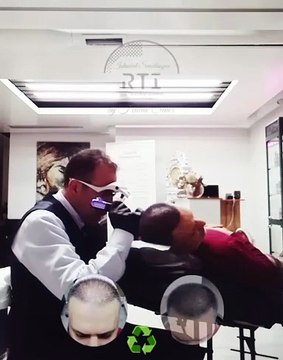 Saç Simülasyonu Saç Çözüm Merkezi Doğru Adres By Haluk Şener Telefon Aşağıda instagram @byhaluksener