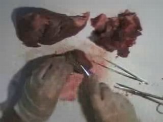 Get well soon - automatic heart