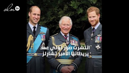 تورُّم يدي وقدمي الأمير تشارلز يُثير القلق