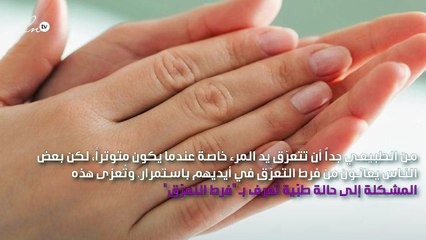 كل ما تحتاجين إلى معرفته عن الحلّ لمشكلة تعرّق الكفّين