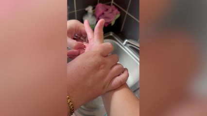 Woman Struggles to Take Wedding Ring off