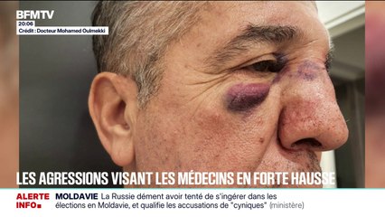 "Il a essayé de me frapper avec la chaise": depuis 2021, les violences sur les médecins ont augmenté de 95%