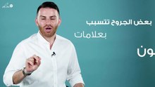 كيف تتجنّبين ندبات الجرح؟ د.كوستي