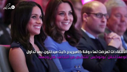 حقنة "بوتكس" لكيت ميدلتون تُثير ضجة في العائلة المالكة