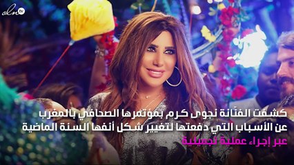 نجوى كرم تتحدّث عن تجميل أنفها في موازين