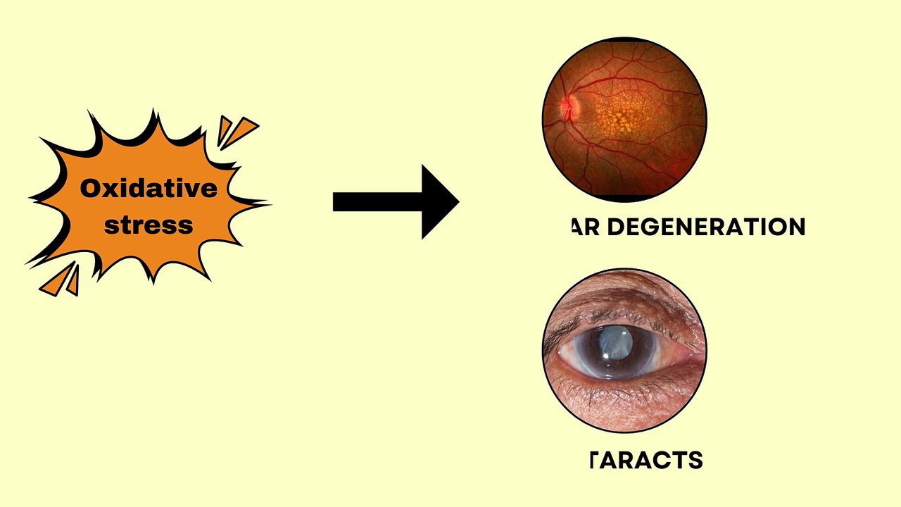 Food for your Eye, Tips Olive oil benefits #oliveoil