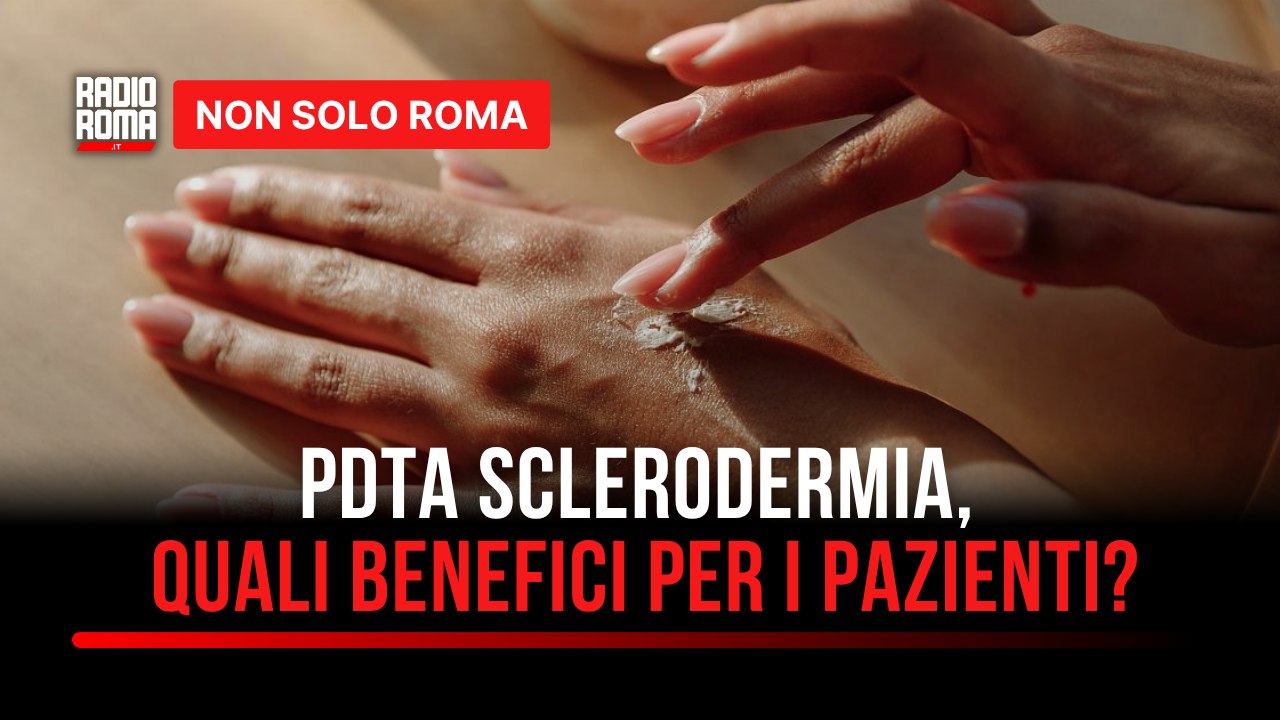 As.Ma.Ra Onlus, il convegno per celebrare un risultato importante il PDTA della Sclerodermia