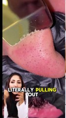 Skincare face wash pimple pulling out