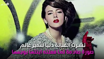 ماذا فعلت ابنة دنيا سمير غانم بوجه والدتها.. صدمة!