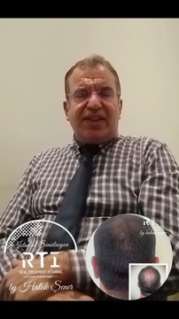 3. SAÇ SİMÜLASYONU DETAYLI ANLATIM (SAÇ SİMÜLASYONU AKADEMİSİ)