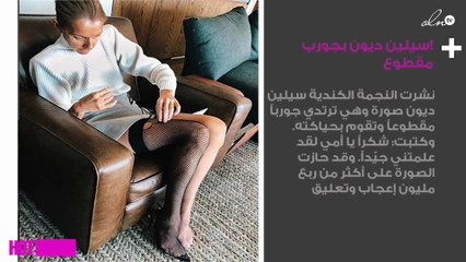 !سيلين ديون تُفاجِئ جمهورها بجورب مقطوع
