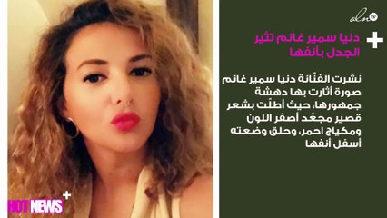 دنيا سمير غانم تثير الجدل بأنفها