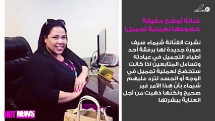 شيماء سيف تُوضّح حقيقة خضوعها لعملية تجميل!