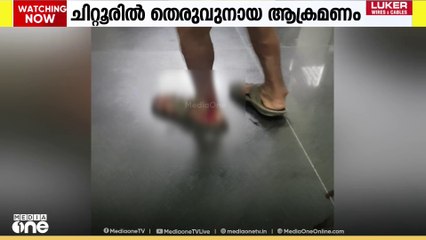 ആശുപത്രിയുടെ മുന്നിൽ വെച്ച് വയോധികന്റെ കാല് കടിച്ചു പറിച്ച് തെരുവുനായ