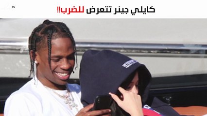 آثار الضرب على وجه كايلي جينر تُثير التساؤلات حول والد طفلتها