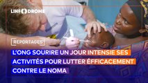 redonner le sourire aux enfants victimes du noma, le combat de l’association sourire un jour